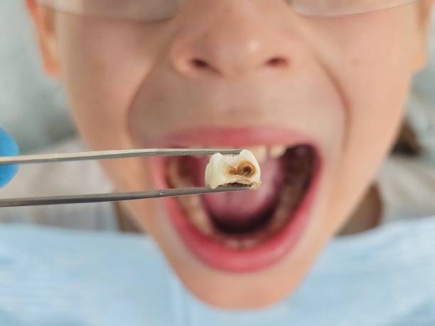 Best Emergency Gum Pain Relief  in Trenton, OH