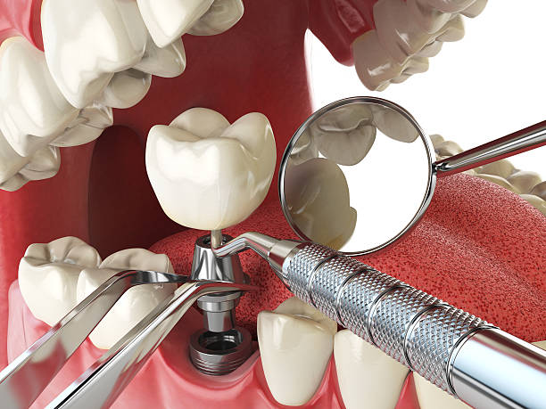 Best Root Canal Emergency Dentist  in Trenton, OH